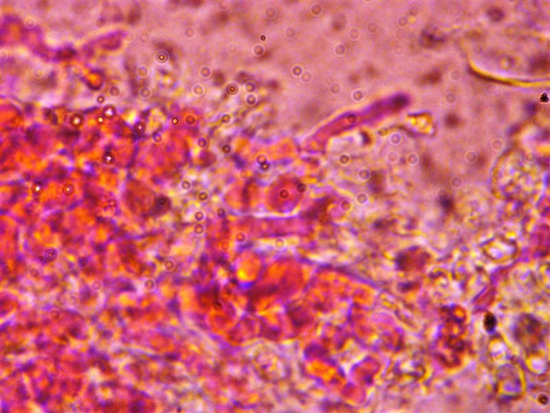 Crosta da determinare (Peniophora incarnata)